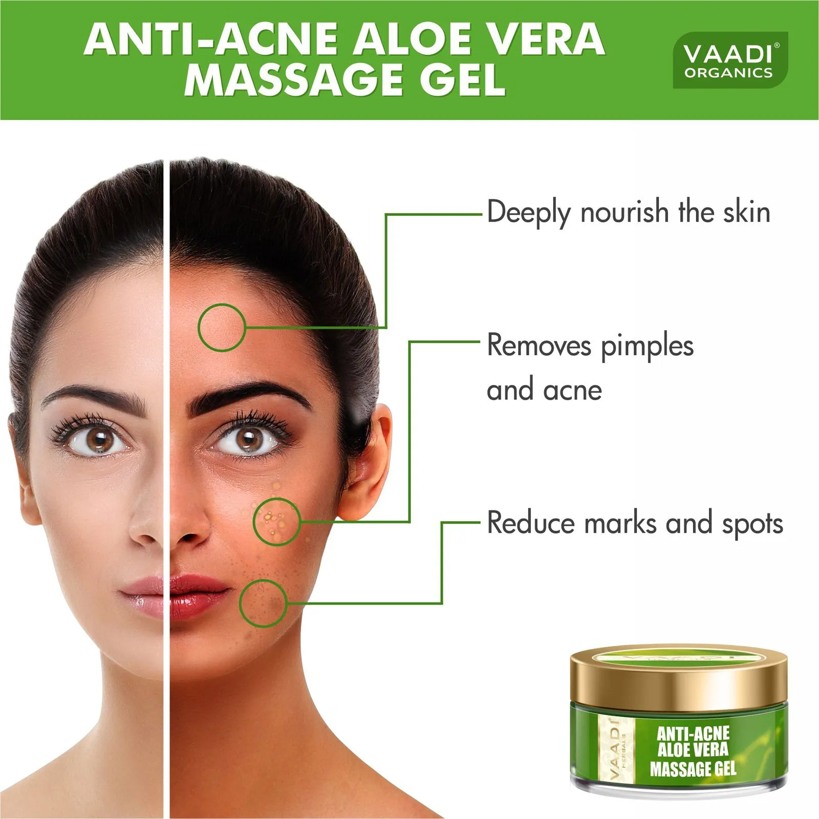 Anti-Acne Aloe Vera Massage Gel (50 gms)